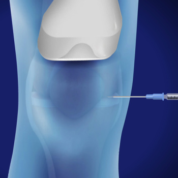 Injections into joints under ultrasound guidance